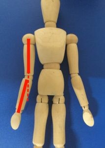 肘が曲がってる 外反肘について解説します 整体サロンsunrise